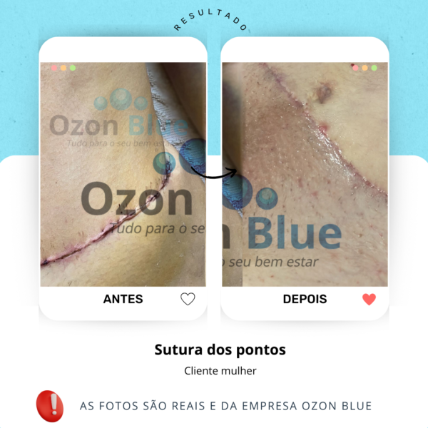 Óleo de Girassol Ozonizado 3