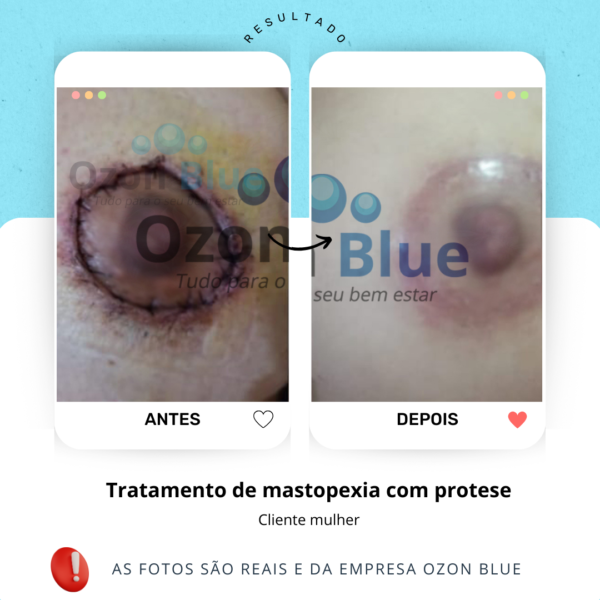 Óleo de Girassol Ozonizado 3