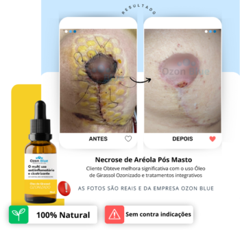 Óleo de Girassol Ozonizado 3