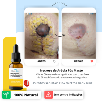 Óleo de Girassol Ozonizado 3